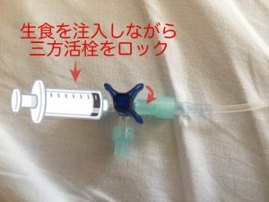 生食ロックの方法はこれで完璧 陽圧ロックって何 どうすれば詰まらない どっちもナース